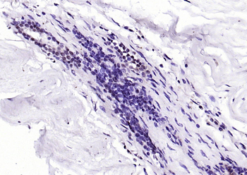 PIN1 Rabbit Polyclonal Antibody