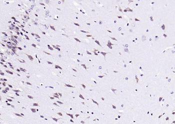 PIN1 Rabbit Polyclonal Antibody