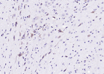 PIN1 Rabbit Polyclonal Antibody