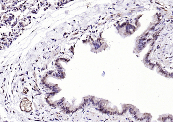 PIN1 Rabbit Polyclonal Antibody