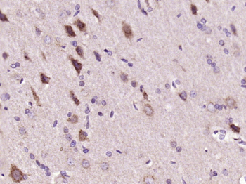 Phospho-PIK3R2 (Tyr467) Rabbit Polyclonal Antibody