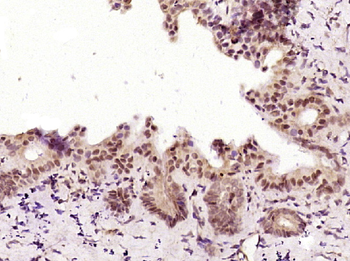 Phospho-PKC alpha (Thr638) Rabbit Polyclonal Antibody