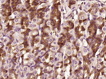 Phospho-PKC alpha (Thr638) Rabbit Polyclonal Antibody