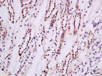 PKC epsilon Rabbit Polyclonal Antibody