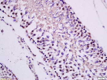 PKC epsilon Rabbit Polyclonal Antibody