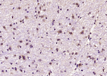 Phospho-PKC gamma (Thr514) Rabbit Polyclonal Antibody