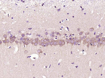 PKC delta Rabbit Polyclonal Antibody