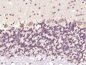 PKC delta Rabbit Polyclonal Antibody