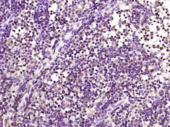 Phospho-PKC delta (Tyr52) Rabbit Polyclonal Antibody