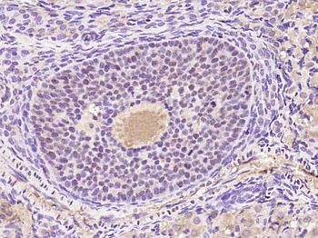 Phospho-PKC delta (Tyr52) Rabbit Polyclonal Antibody