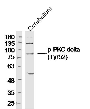 Phospho-PKC delta (Tyr52) Rabbit Polyclonal Antibody