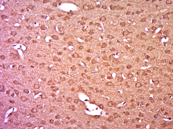 Phospho-PKC delta (Tyr52) Rabbit Polyclonal Antibody