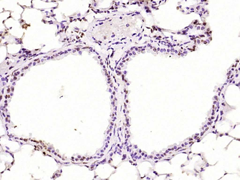 Phospho-PKC delta (Thr505) Rabbit Polyclonal Antibody