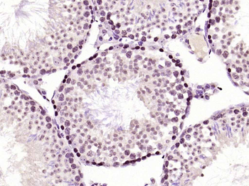 Phospho-PKC delta (Thr505) Rabbit Polyclonal Antibody