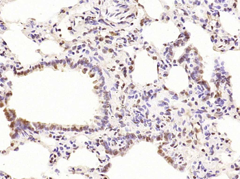 Phospho-PKC delta (Thr505) Rabbit Polyclonal Antibody