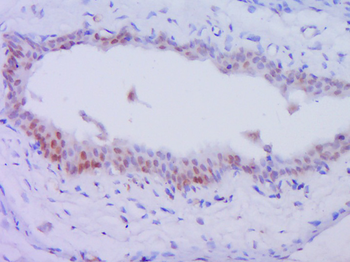 Phospho-PKC delta (Thr505) Rabbit Polyclonal Antibody