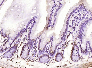 Phospho-PKC delta (Tyr311) Rabbit Polyclonal Antibody