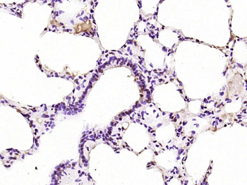 Phospho-PKC delta (Tyr311) Rabbit Polyclonal Antibody