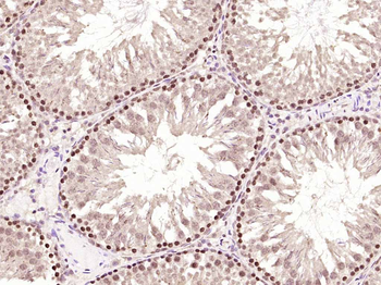 Phospho-PKC delta (Tyr311) Rabbit Polyclonal Antibody