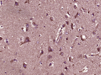 Phospho-PKC delta (Ser645) Rabbit Polyclonal Antibody