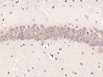 Phospho-PKC delta (Ser645) Rabbit Polyclonal Antibody