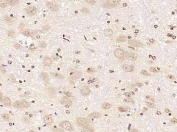 Phospho-PKC delta (Ser645) Rabbit Polyclonal Antibody