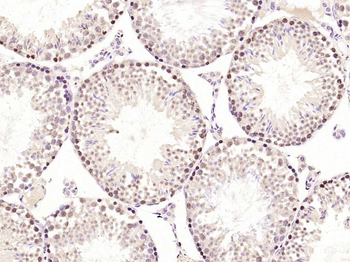 Phospho-PKC delta (Ser645) Rabbit Polyclonal Antibody