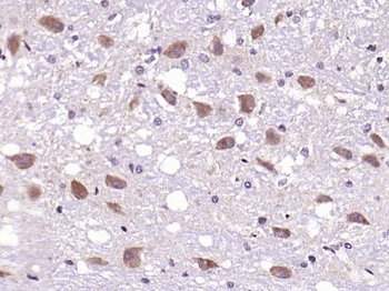 Phospho-PKC delta (Ser645) Rabbit Polyclonal Antibody