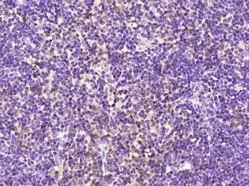 Phospho-PKC delta (Ser645) Rabbit Polyclonal Antibody