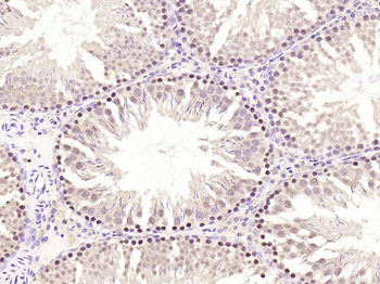 Phospho-PKC delta (Ser645) Rabbit Polyclonal Antibody