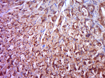 Phospho-PKC delta (Ser645) Rabbit Polyclonal Antibody