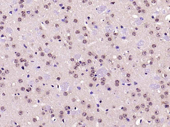 Phospho-PRKCB (Thr642) Rabbit Polyclonal Antibody