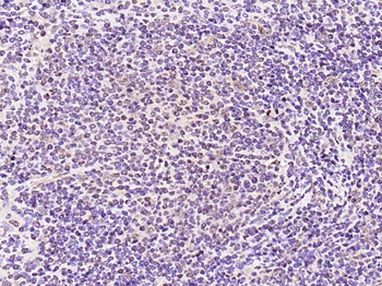 Phospho-PRKCB (Thr642) Rabbit Polyclonal Antibody