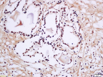 Phospho-PRKCB (Thr642) Rabbit Polyclonal Antibody