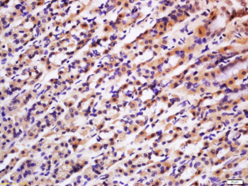 Phospho-PRKCB (Thr642) Rabbit Polyclonal Antibody