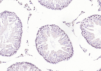 PLK1 Rabbit Polyclonal Antibody