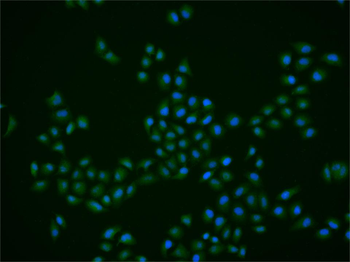 PLK1 Rabbit Polyclonal Antibody