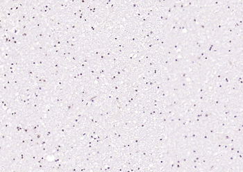 PLK1 Rabbit Polyclonal Antibody