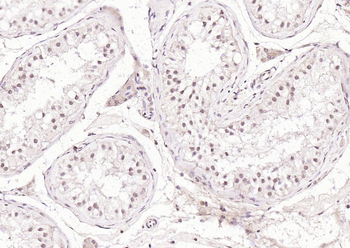 PLK1 Rabbit Polyclonal Antibody