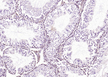 PLK1 Rabbit Polyclonal Antibody