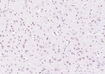 PLK1 Rabbit Polyclonal Antibody