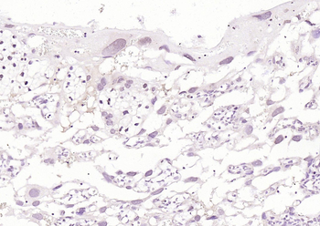 PLK1 Rabbit Polyclonal Antibody