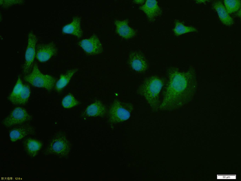 PNMT Rabbit Polyclonal Antibody