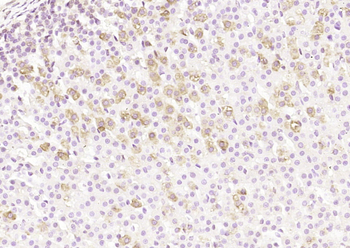 PNMT Rabbit Polyclonal Antibody
