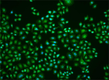 Phospho-PPM1A (Ser375) Rabbit Polyclonal Antibody