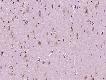 Phospho-PPM1A (Ser375) Rabbit Polyclonal Antibody