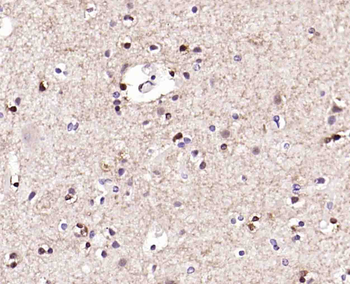 Phospho-PPM1A (Ser375) Rabbit Polyclonal Antibody