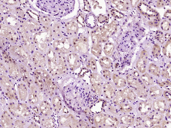 Phospho-PPM1A (Ser375) Rabbit Polyclonal Antibody