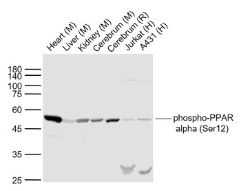 Phospho-PPAR alpha (Ser12) Rabbit Polyclonal Antibody