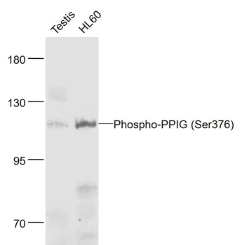 Phospho-PPIG (Ser376) Rabbit Polyclonal Antibody